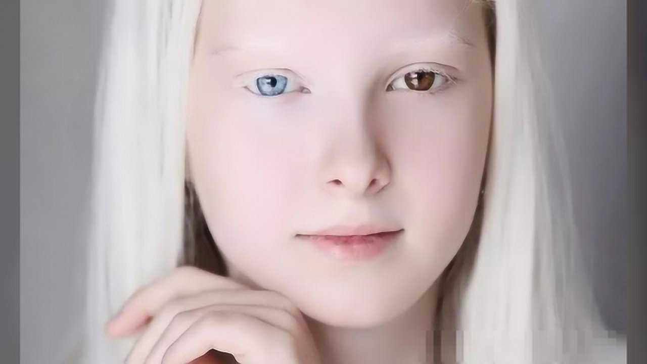 俄罗斯白化病瞳孔异色症少女照片惊艳网络,网友称她的美超凡脱俗