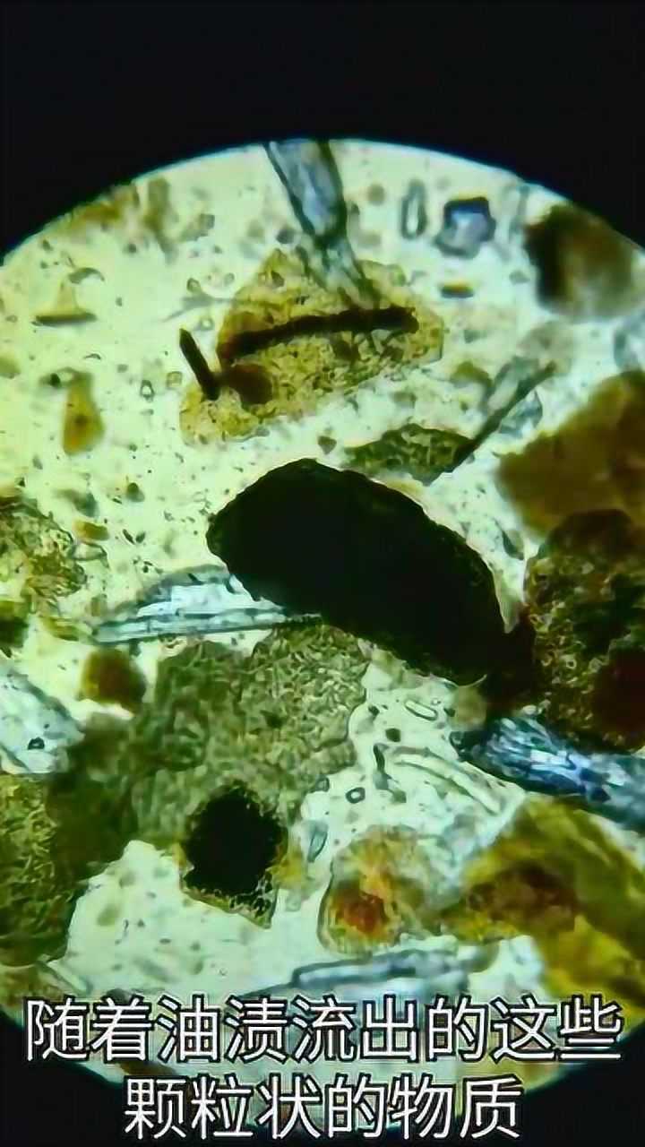 辣条放在显微镜照射,放大后看到这一幕,身体已经受不了了