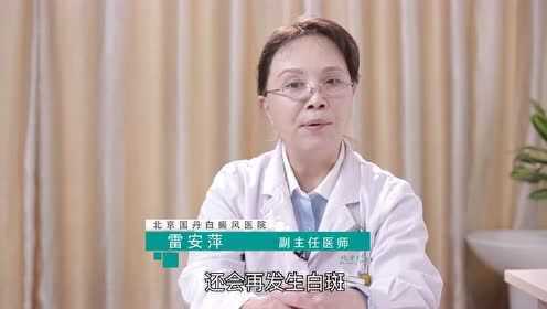 北京国丹白癜风雷安萍 白癜风植皮手术后会复发吗？
