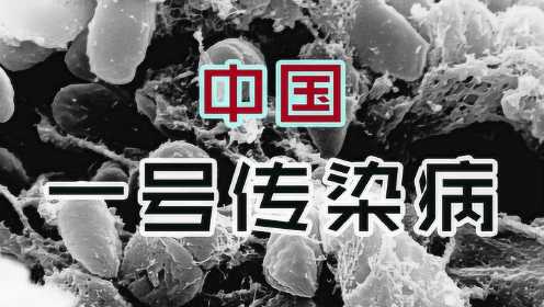 中国最高级别甲类传染病只有两个：鼠疫和霍乱都不是病毒引起的！