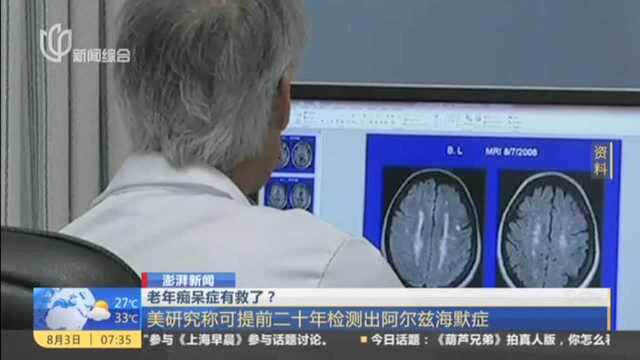 老年痴呆症有救了?美研究称可提前20年检测出来