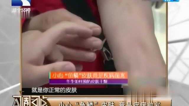 医生提醒:小心“鱼鳞”皮肤,有可能是疾病的前兆