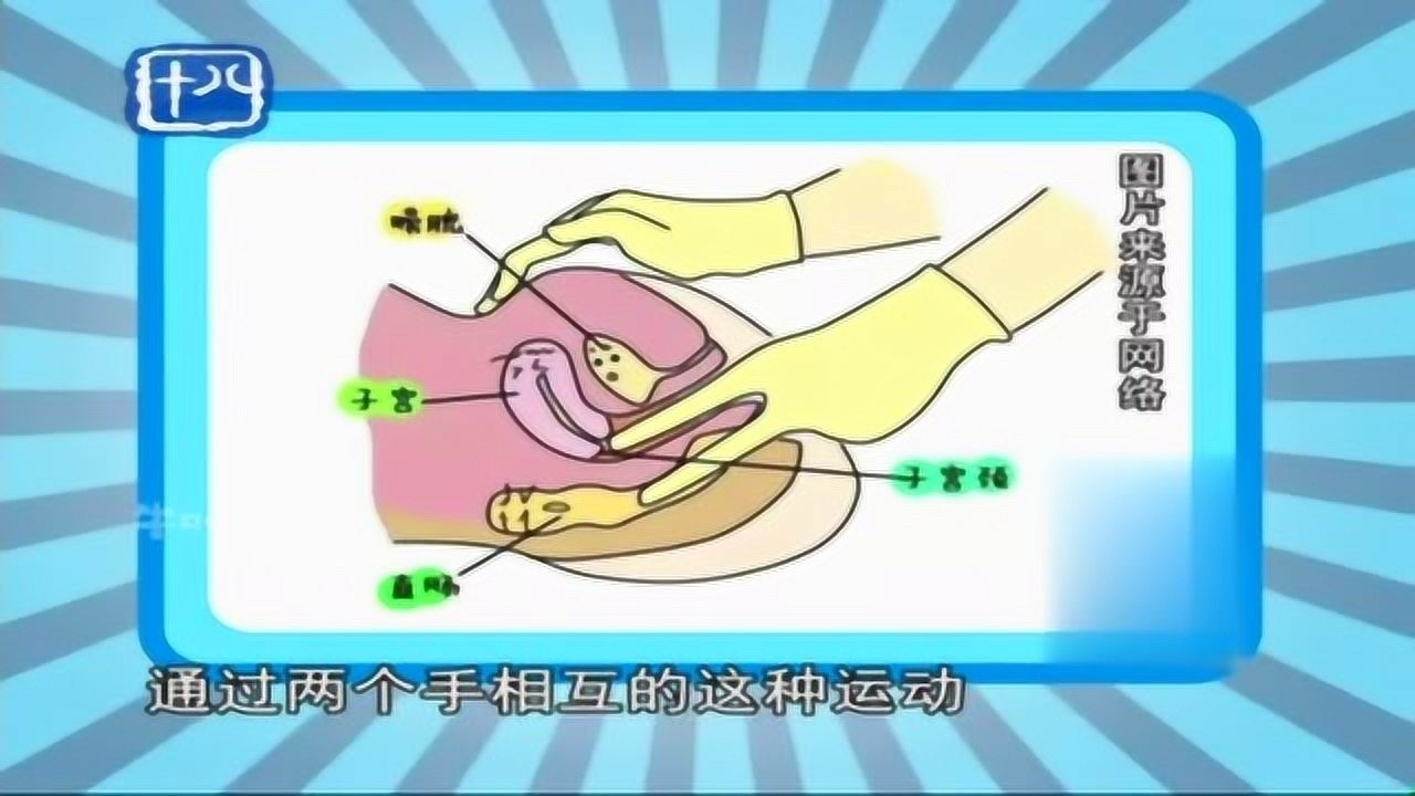 妇科检查：正确认识“三合诊检查”，对宫颈癌的排查有重要作用_腾讯视频