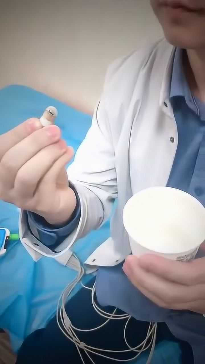 胃镜的胶囊吞下去的瞬间表情都不一样了