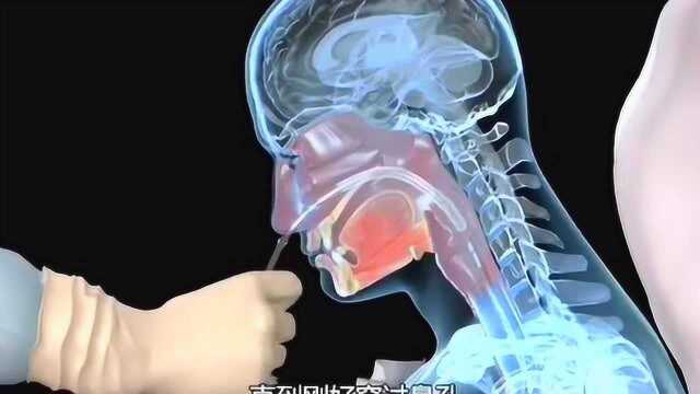 3D演示洗胃整个过程,看到感觉太痛苦了,一定要好好爱护自己的身体!