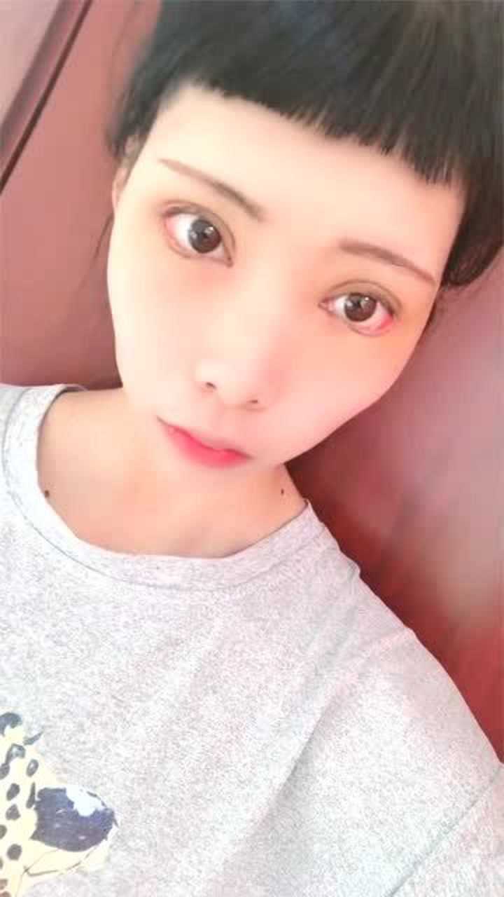 妹子疯狂整容,这双眼皮割的也太吓人了吧,感觉能夹死苍蝇