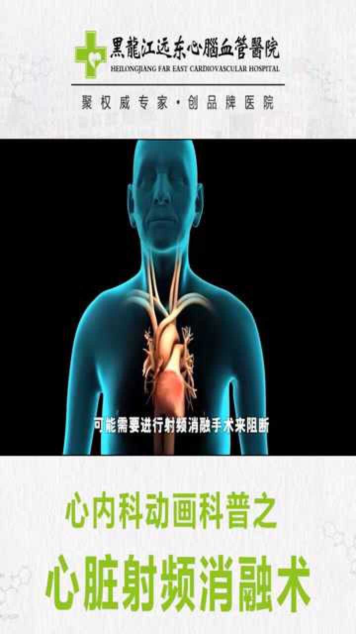 心内科动画科普之心脏射频消融术【动画科普】_高清
