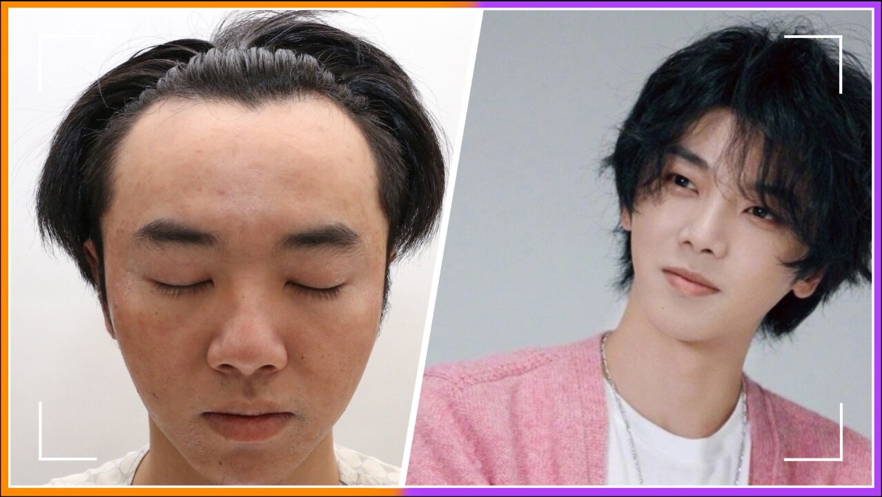 华晨宇整容前模样