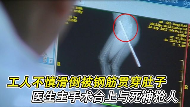 工人不慎滑倒被钢筋贯穿肚子,外科急诊主手术台上与死神抢人《急诊室故事第二季》纪录片