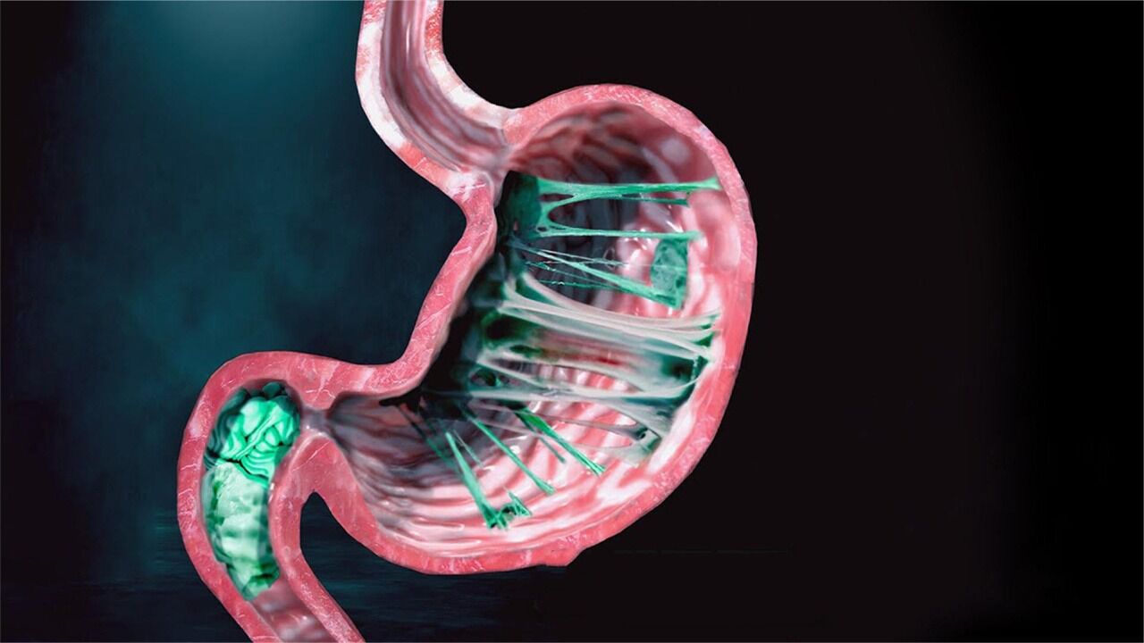 误吞进肚子里的口香糖,最后都去哪了?真在胃里留7年?