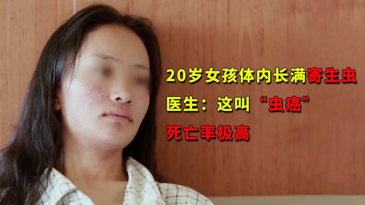 女孩患上"虫癌,医生开刀一看,肝脏爬满整整2斤的虫子