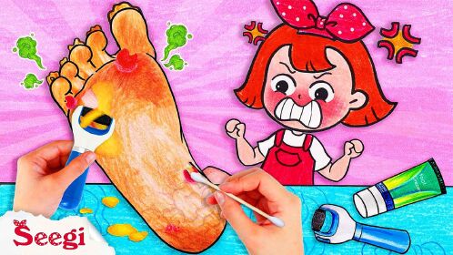 趣味定格动画脚意外扭伤肿得像包子一样帮小美做足部护理吧