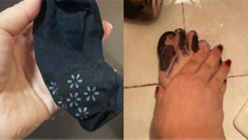 袜子掉色染黑脚趾，女子洗几天都不干净笑翻网友：两毛五的袜子？