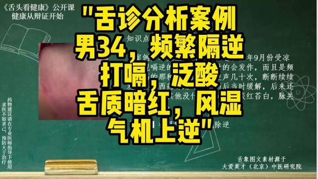 舌诊分析案例:频繁隔逆,打嗝,泛酸,舌质暗红,风湿,气机上逆