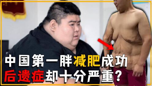 中国第一胖王浩楠680斤,减肥成功获爱情,肥胖究竟会带来什么?_高清1080P在线观看平台_腾讯视频