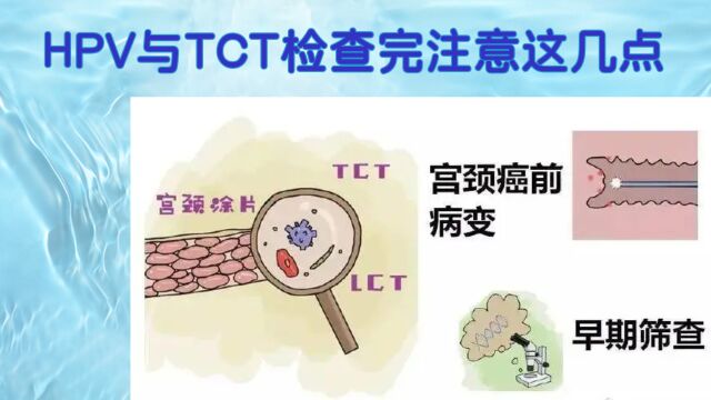 做hpv与tct检查之前,注意这几点,结果才更准确