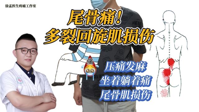 尾骨痛、多裂回旋肌损伤、尾骨肌损伤、坐着躺着痛、压痛发麻