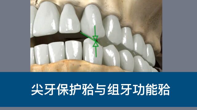 尖牙保护𐬌—与组牙功能𐬌—