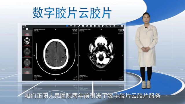 正阳人民医院数字胶片