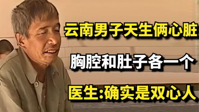 云南男子天生两颗心脏,胸腔和肚子各一个,医生:确实是双心人!