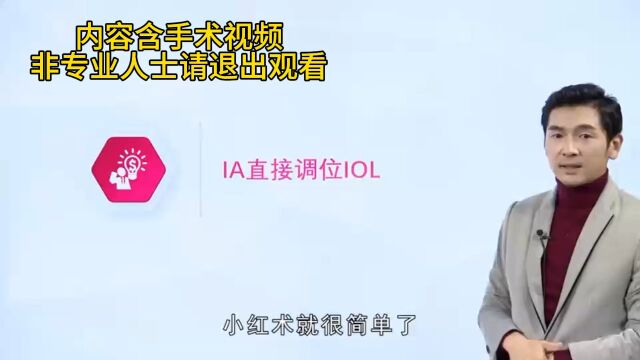 IOL手术视频—内容含手术过程,非专业人士请退出观看