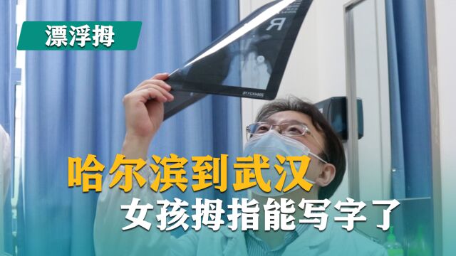 漂浮拇:成功保五指|第24集 哈尔滨到武汉,女孩拇指能写字了