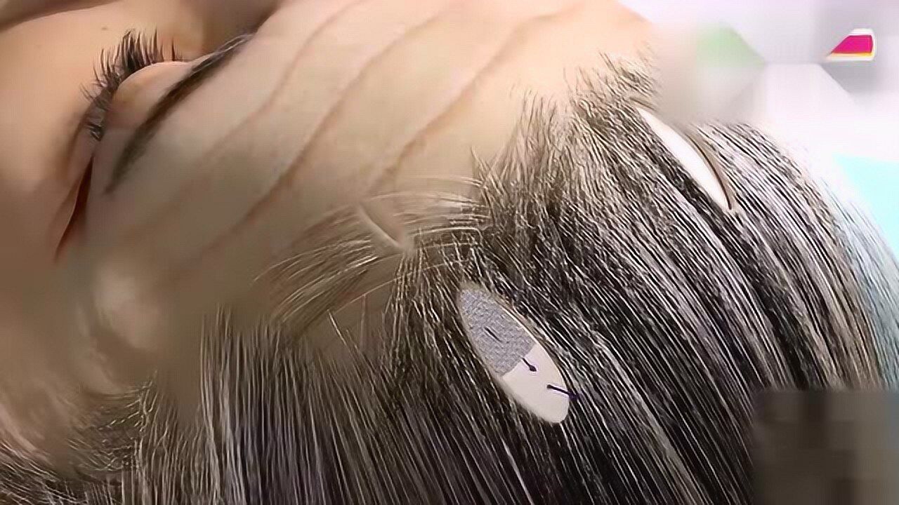 拉皮手术是如何操作的？看完感觉好疼！_高清
