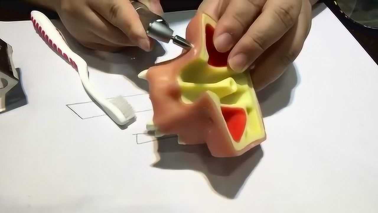 牙龈环切刀使用说明