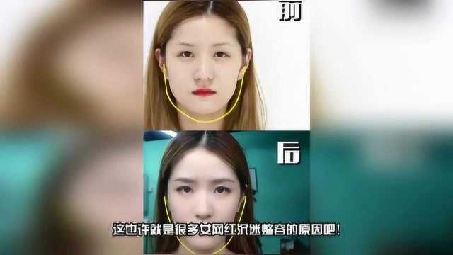 女网红记录打完瘦脸针后15天的变化 看到最后让人不敢相信!