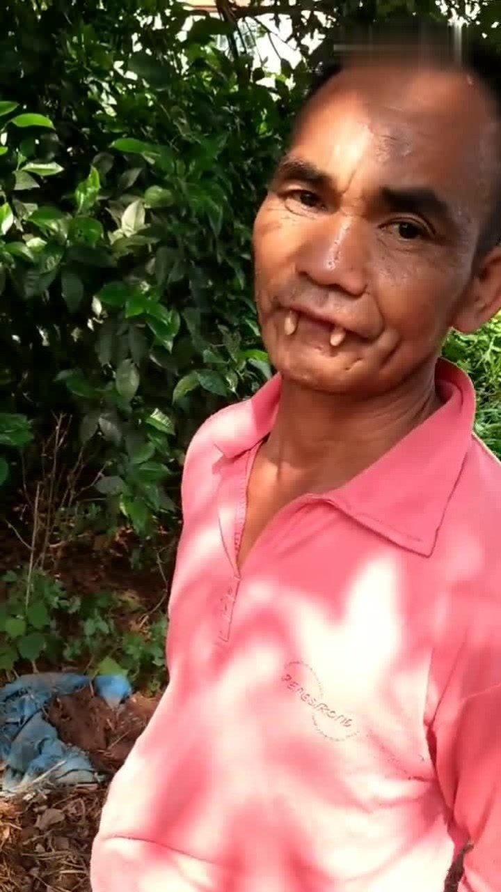 这算是僵尸牙吗?_腾讯视频