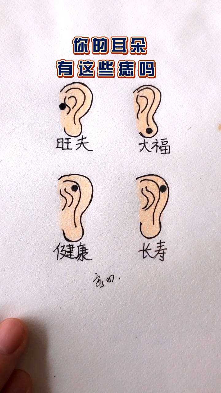 耳朵长痣代表什么图片