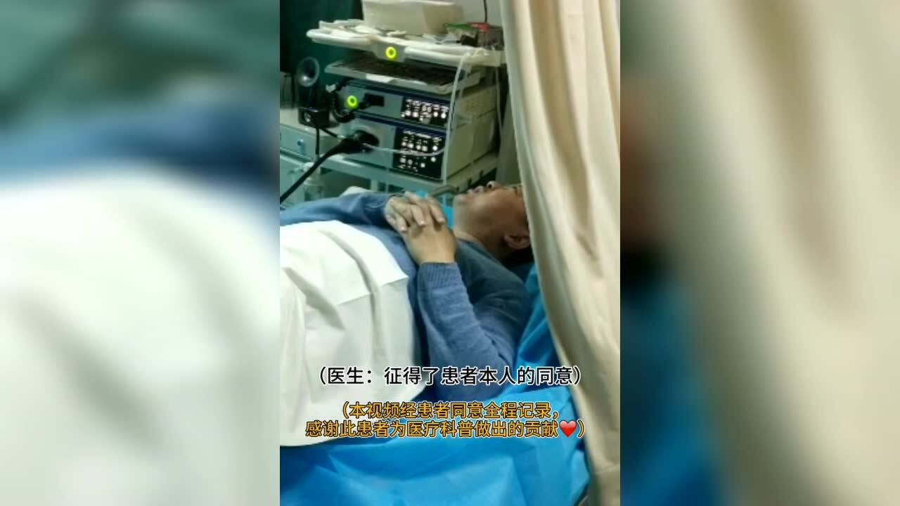 肠镜检查全过程（下集），直击肠内息肉镜下切除！_高清