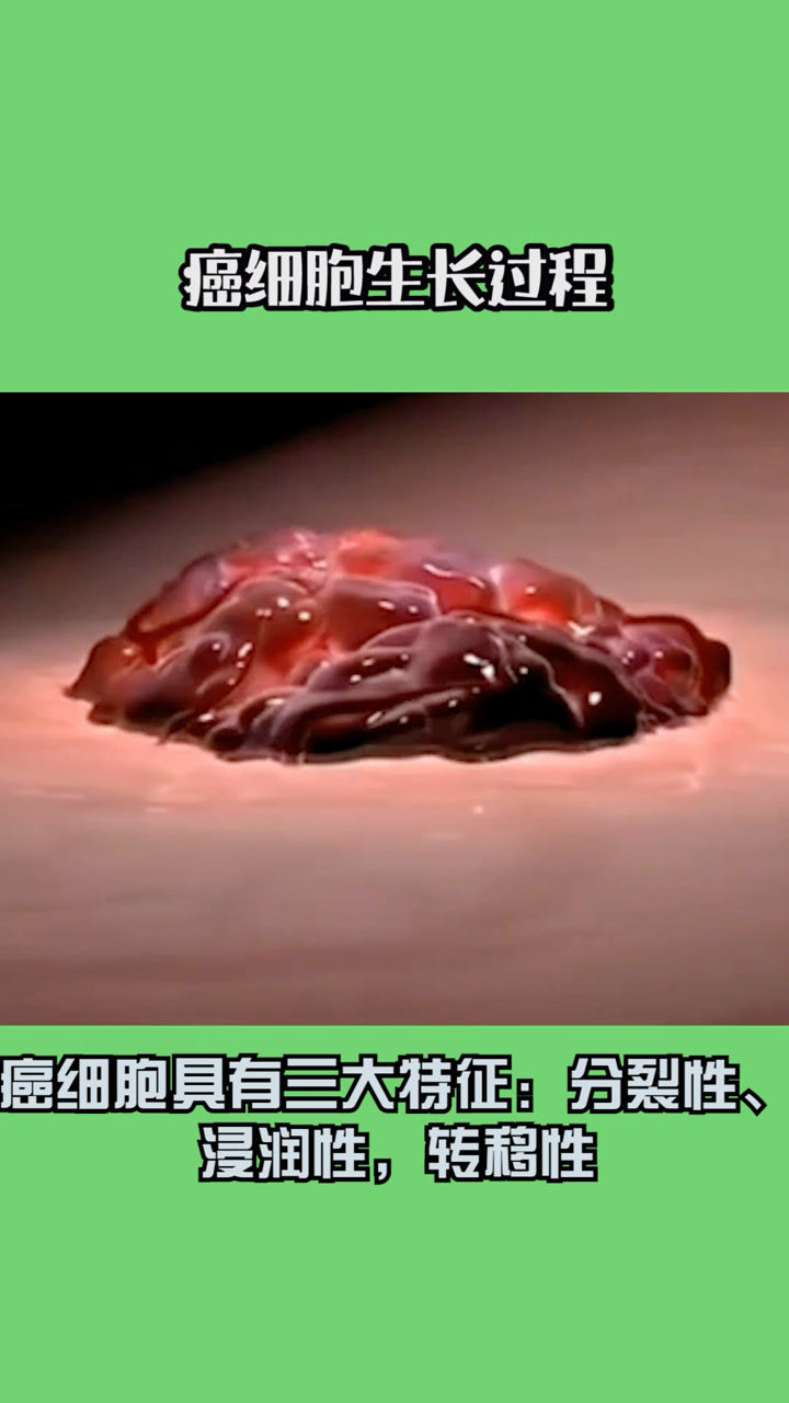 癌细胞生长过程，看得我惊呆了！_高清