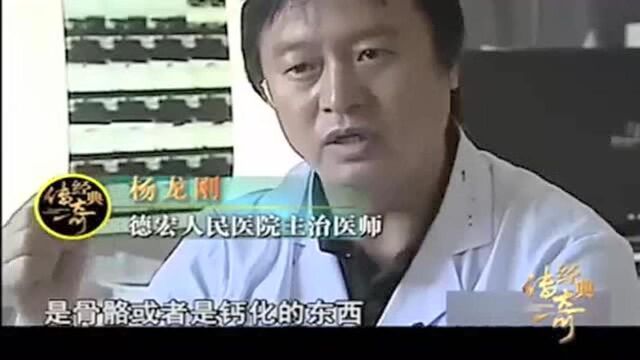 男子带着玉石来到了医院,却找了放射科的医生