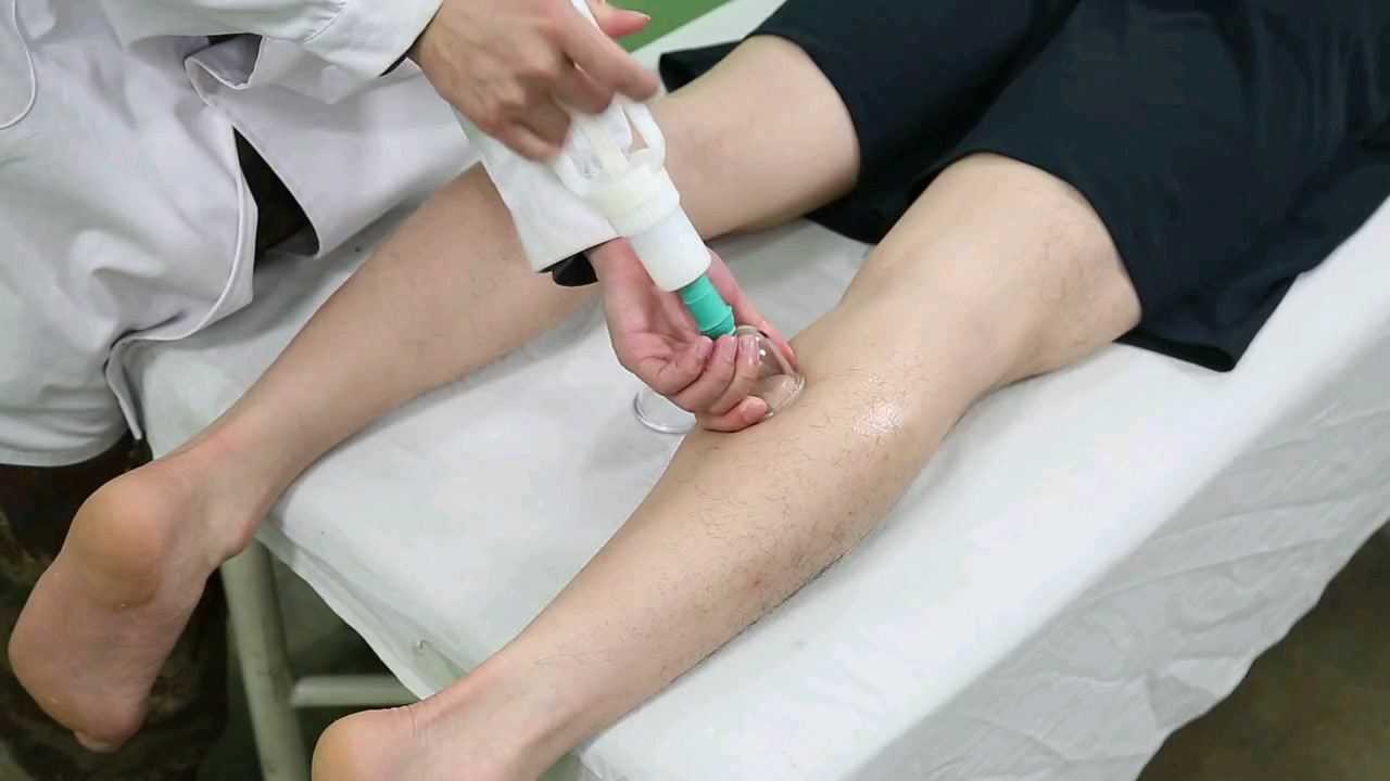 拔罐小腿大腿的位置图图片