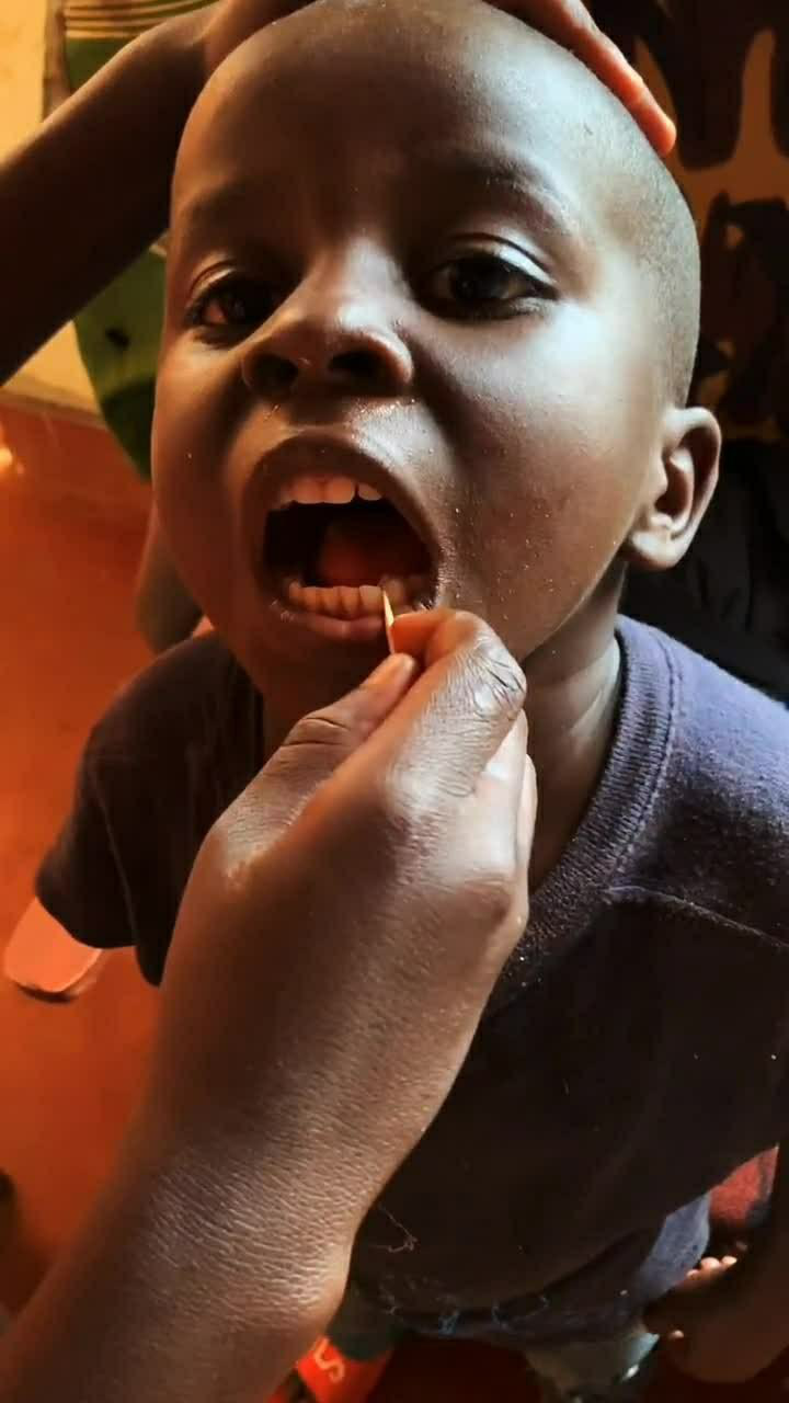 非洲小朋友吃肉塞牙了,这个场面很搞笑