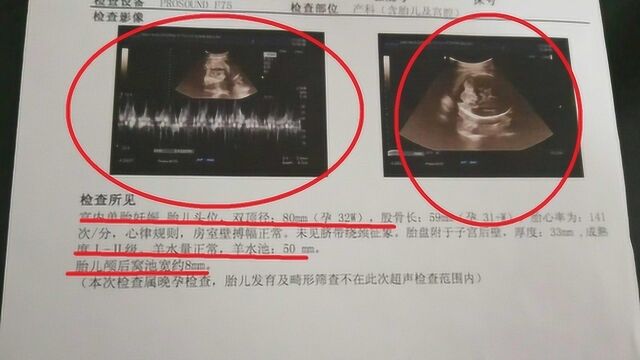 辨别胎儿性别有方法,B超单上写的明明白白,可惜知情的人很少!