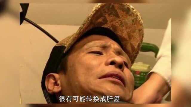 宋小宝病情再度恶化?身体状况令人担忧,娱乐圈可能一退不返