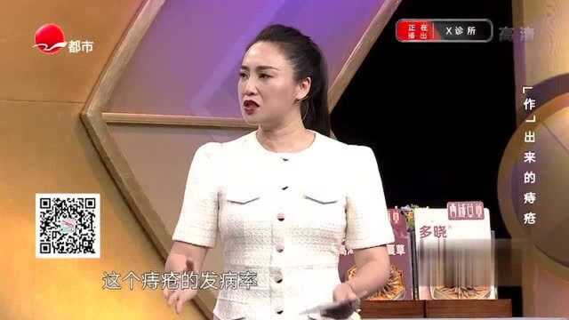 痔疮的发病率有多高?和年纪有关系?女性别害羞,专家给你答案