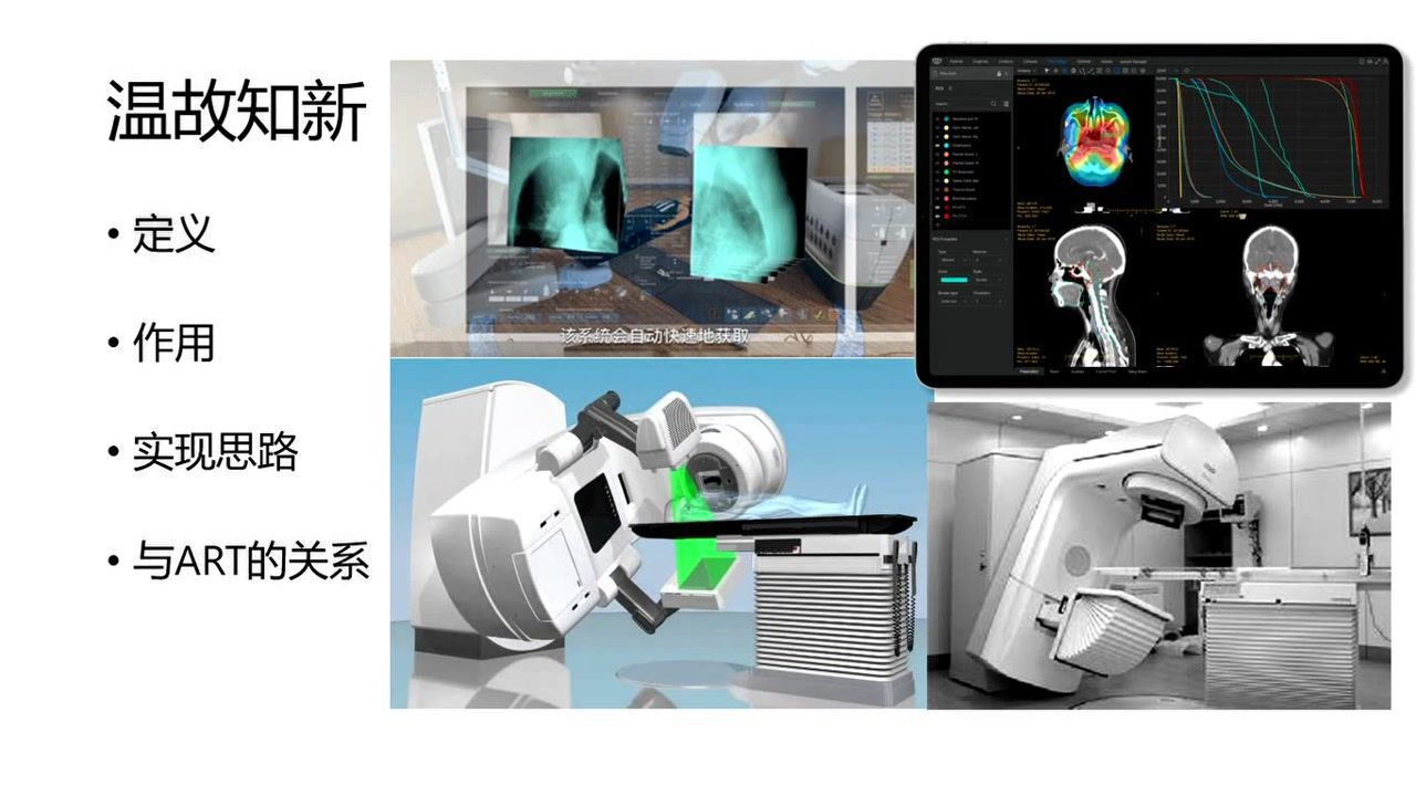 影像引导放疗的成员_高清1080P在线观看平台_腾讯视频