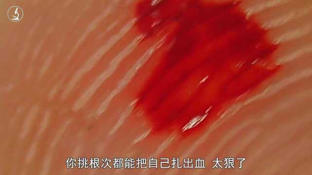 人体血液放大2000倍,无数个血细胞在游动,太壮观了