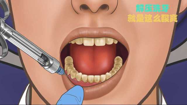 洗牙全过程,看完牙齿隐隐作痛,高分科普短片《洗牙》