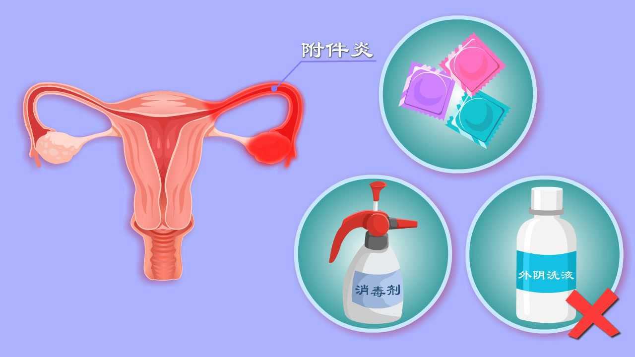 附件炎咋来的?性生活过频、人流惹的祸?硬核干货教你科学预防#知识π计划-知识抢先知#_腾讯视频