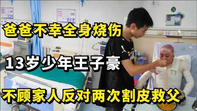 13岁少年王子豪,爸爸不幸全身烧伤,不顾家人反对两次割皮救父