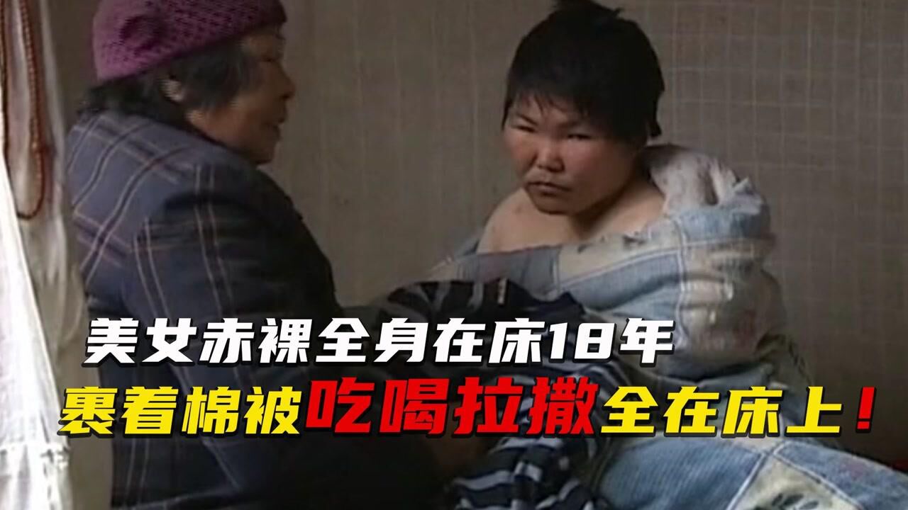 美女赤裸全身在床18年，在床上吃喝拉撒，整日裹着大棉被 ！