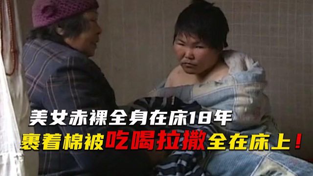 美女赤裸全身在床18年,在床上吃喝拉撒,整日裹着大棉被 !