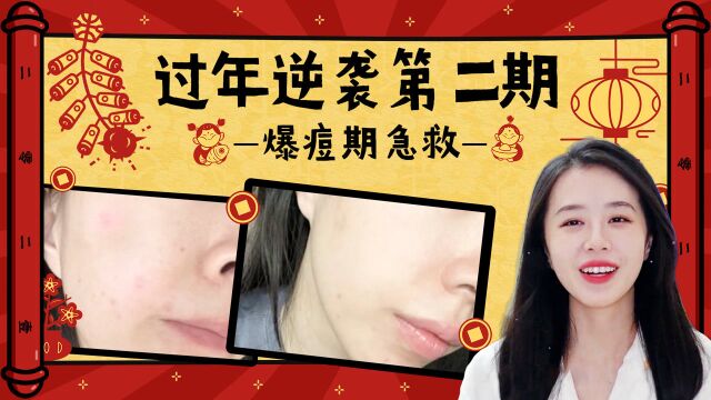 年前逆袭第二弹!爆d女孩看过来!你要悄悄变美然后惊艳所有人!