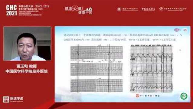 贾玉和教授:宽QRS心动过速的心电图鉴别诊断