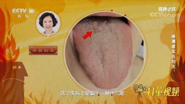 看舌象区分实火还是虚火,专家教你如何分辨,来看看