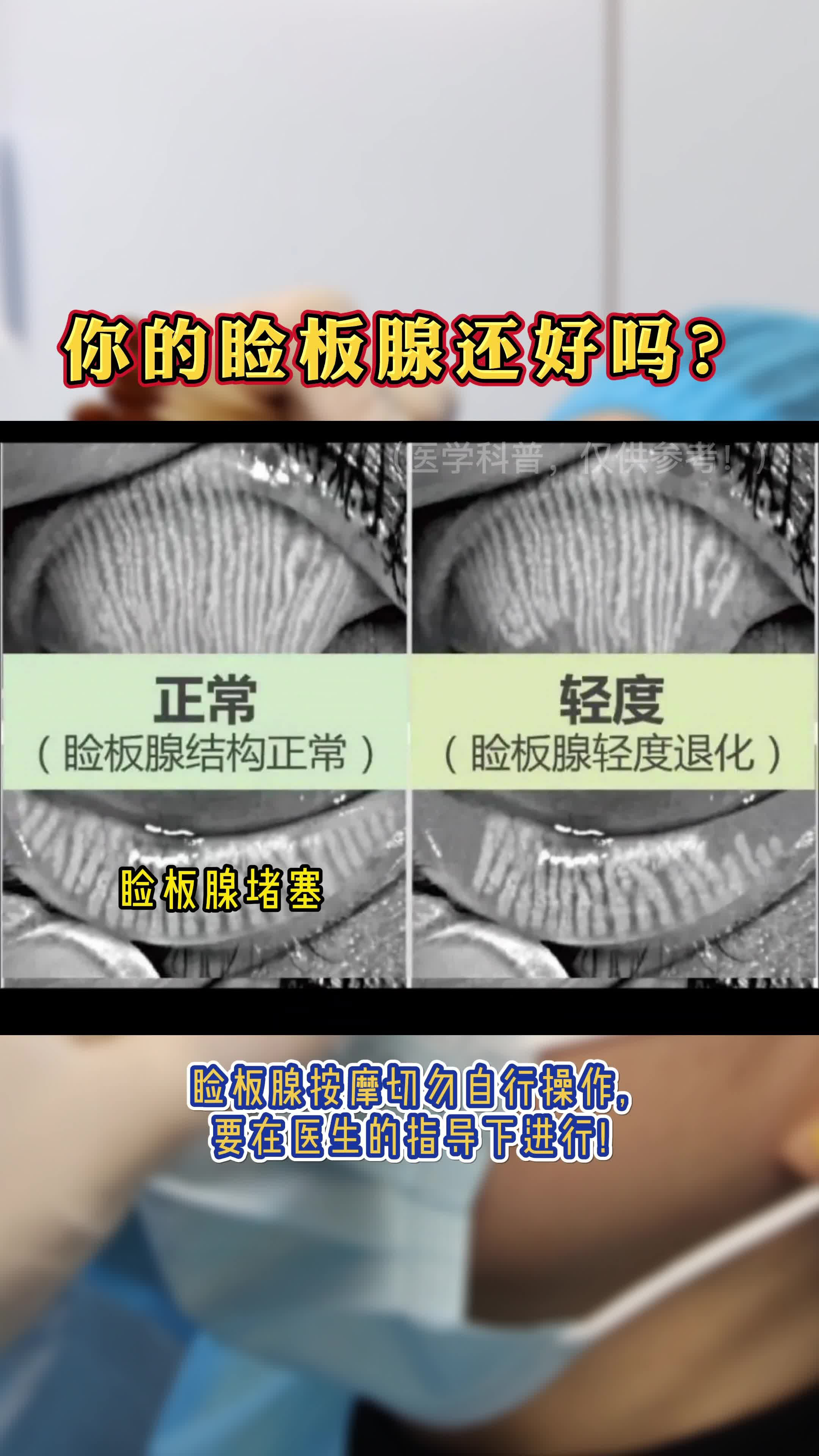 你的瞼板腺還好嗎?